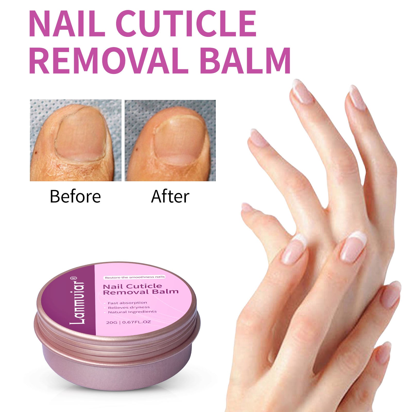 SassyTip Cuticle Removal Balm – 20g Dead Skin Softener