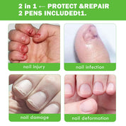 LANTHOME Anti-Nail Biting & Care Duo – Safe & Effective💅🌿