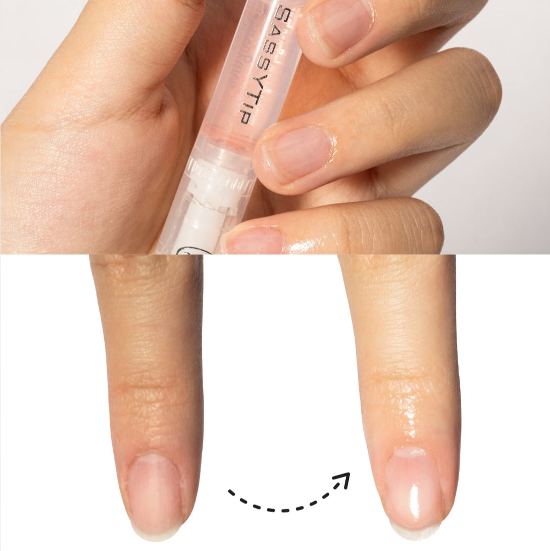 Before and after using SassyTip Nail Strengthener to improve nail health and strength