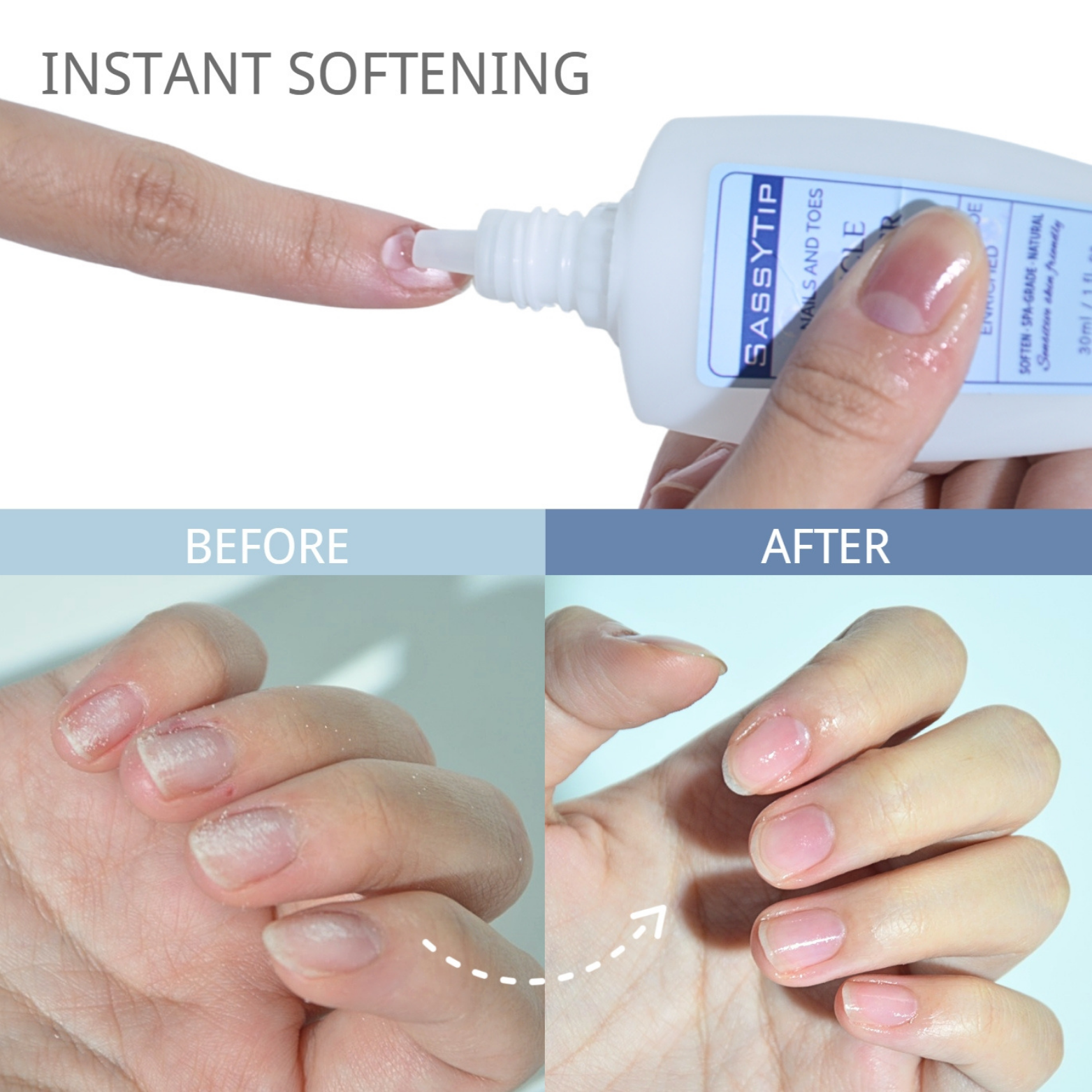 Applying SassyTip Cuticle Cream for intensive cuticle care and nourishment
