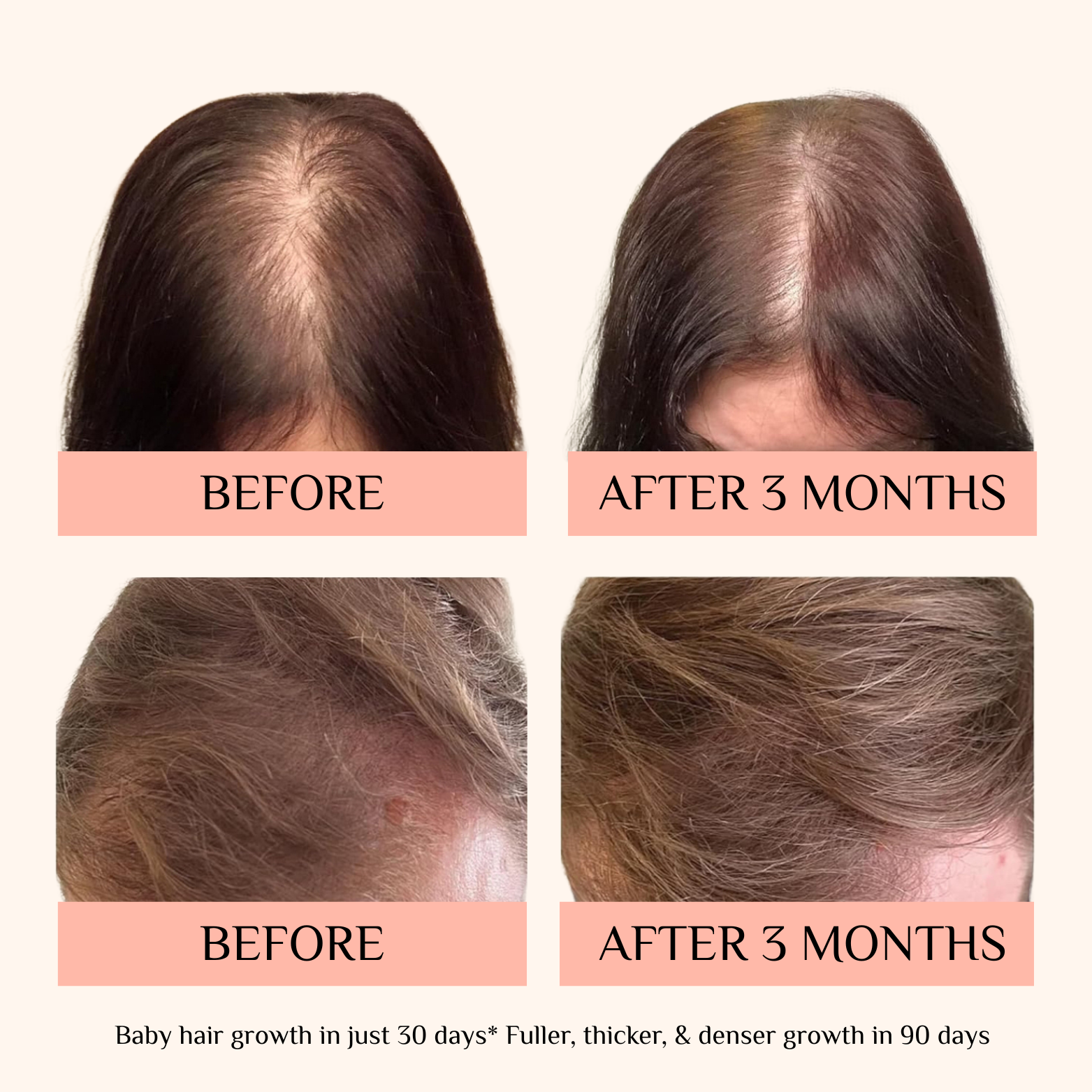 SassyTip Growth Serum – Strength & Silk for Your Hair