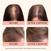 SassyTip Growth Serum – Strength & Silk for Your Hair