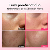 Pink Spicule Serum with Calcium