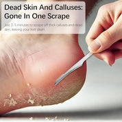【2 count】Hydrating, Moisturizing, Strengthening Cuticle Remover for Dry Cuticles, 30ml, Powered by Blue Cross