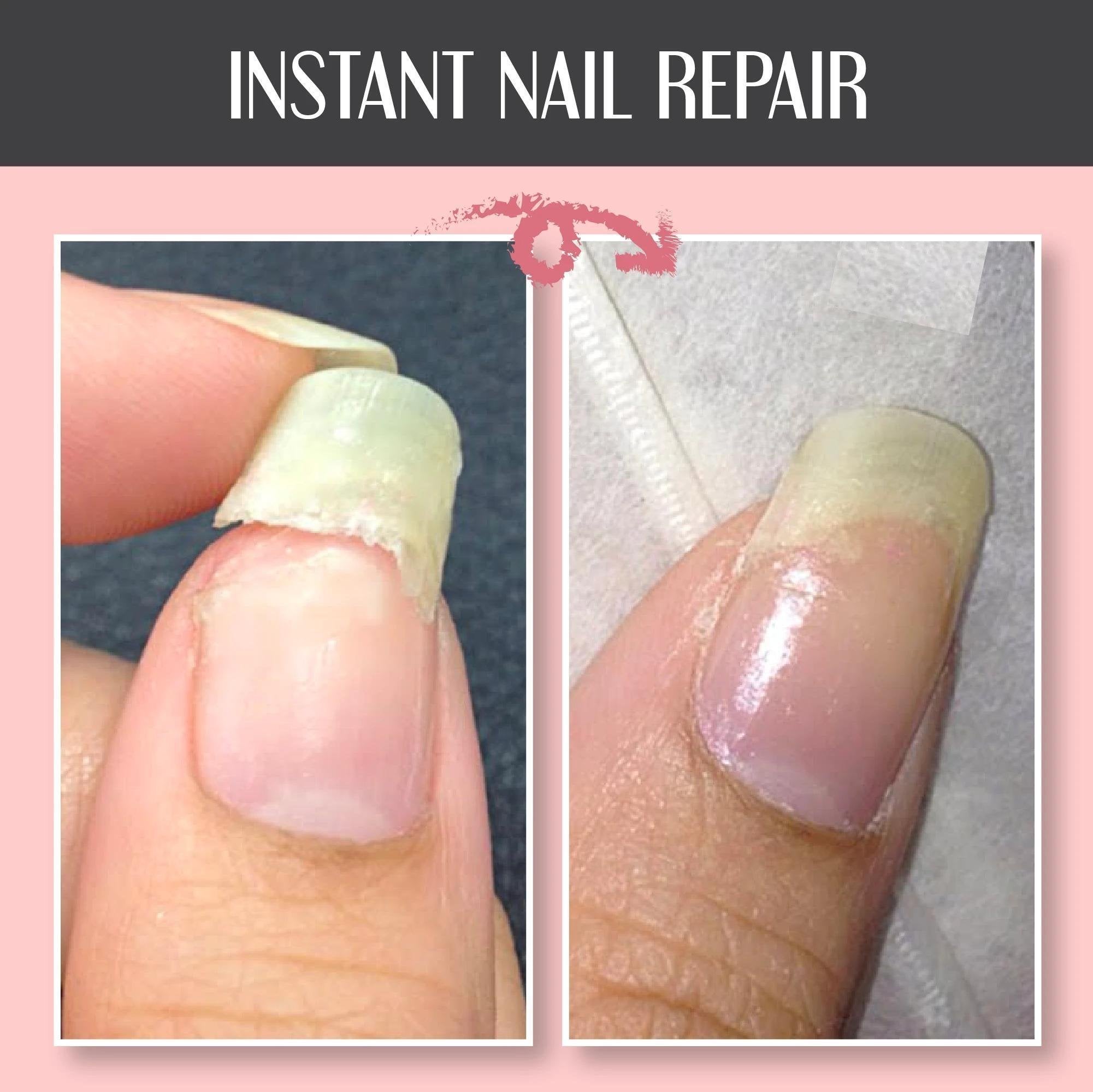 Sassytip & Nail Repair Protection Gel