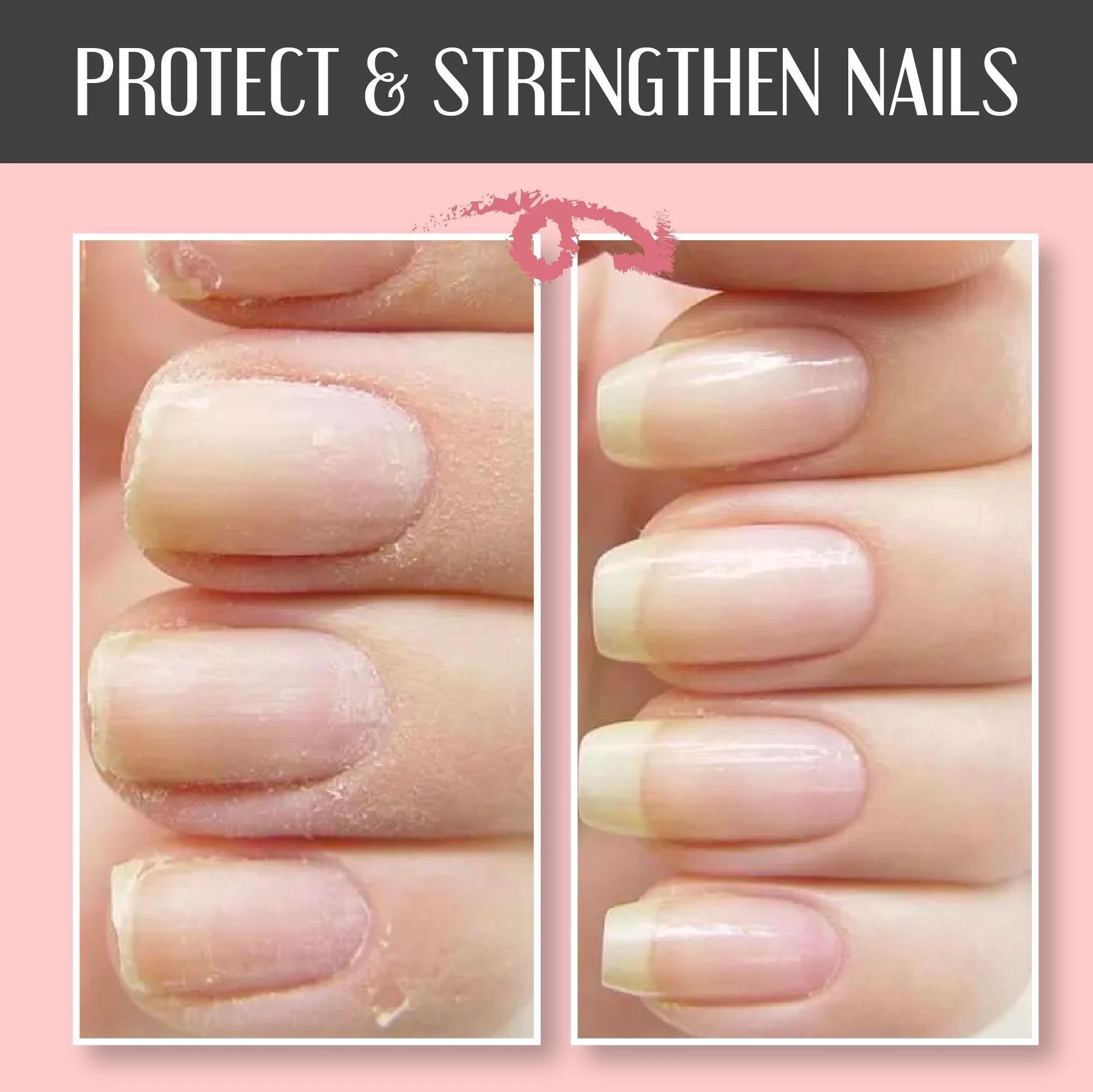Sassytip & Nail Repair Protection Gel