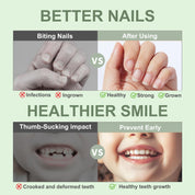 Nail Biting Prevention for Kids – Help Your Child Kick the Habit