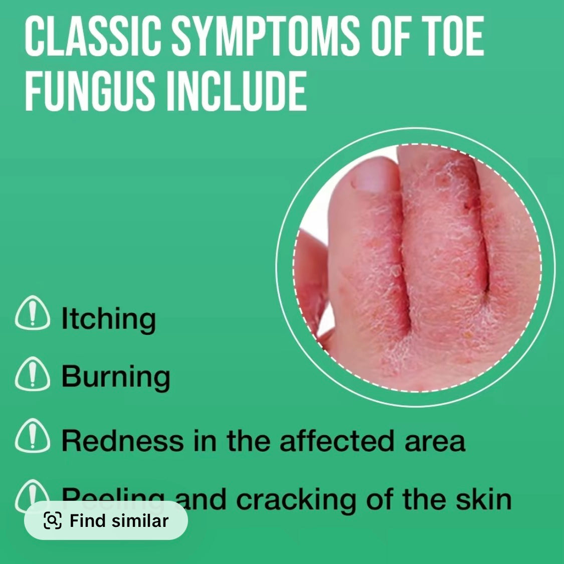 Foot Sanitizer Spray with Tea Tree Oil, antibacterial spray, 100ml