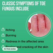 Foot Sanitizer Spray with Tea Tree Oil, antibacterial spray, 100ml