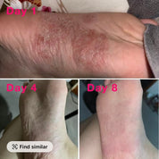 Foot Sanitizer Spray with Tea Tree Oil, antibacterial spray, 100ml