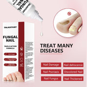 Toenail Fungus Treatment, anti-fungal solution for toenail, 15ml