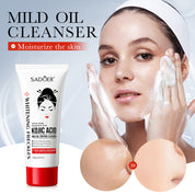 Kojic Acid Gentle Cleanser – Oil-Control & Non-Irritating Face Wash