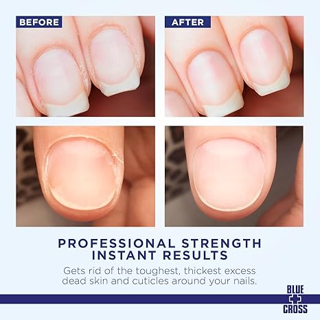 【2 count】Hydrating, Moisturizing, Strengthening Cuticle Remover for Dry Cuticles, 30ml, Powered by Blue Cross