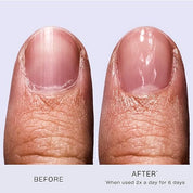 Stronger Nails, Healthier You – Powered by OPI Nail Envy