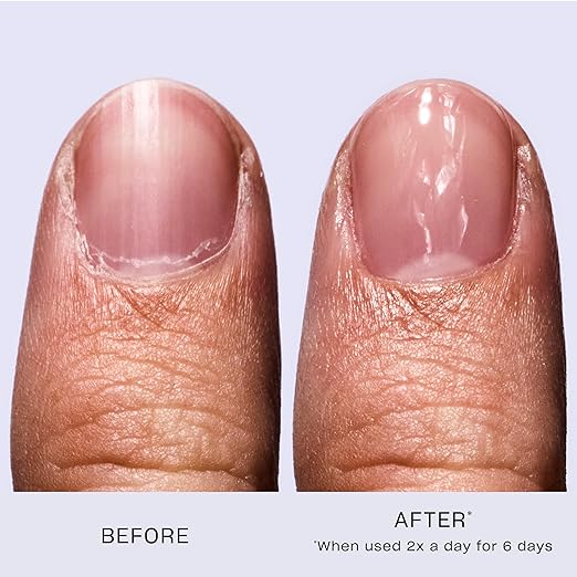 Stronger Nails, Healthier You – Powered by OPI Nail Envy